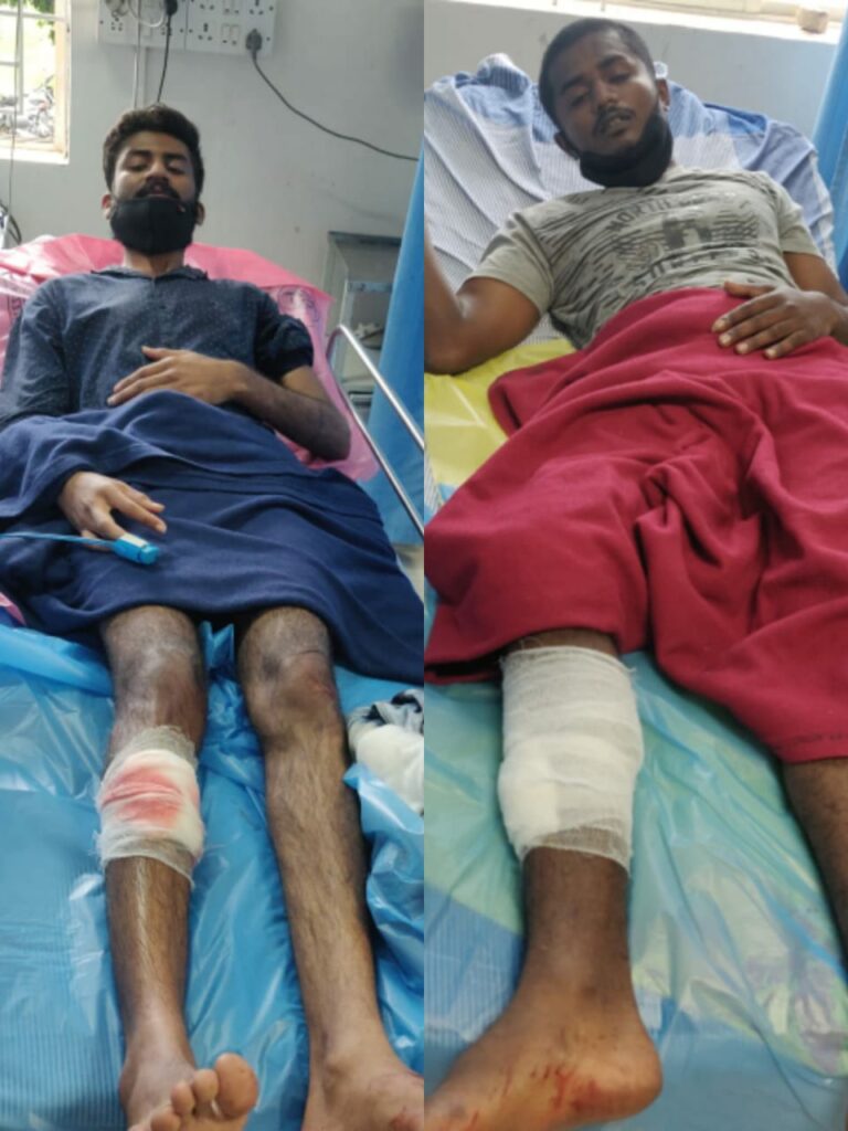 Cops nab 2 'supari' killers after shooting one in leg