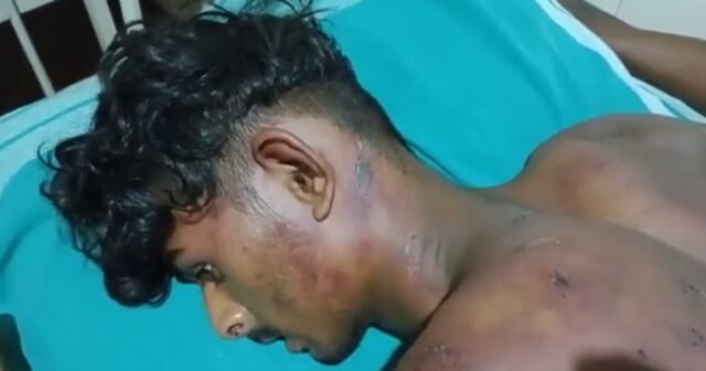 Student attacked for talking to girl in coastal Karnataka, admitted in hospital