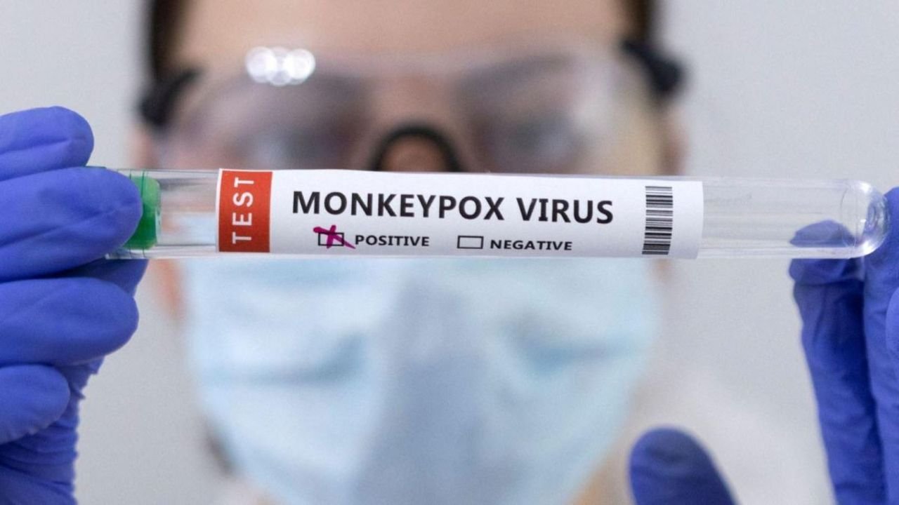 Monkeypox in Africa: Exporters keep fingers crossed