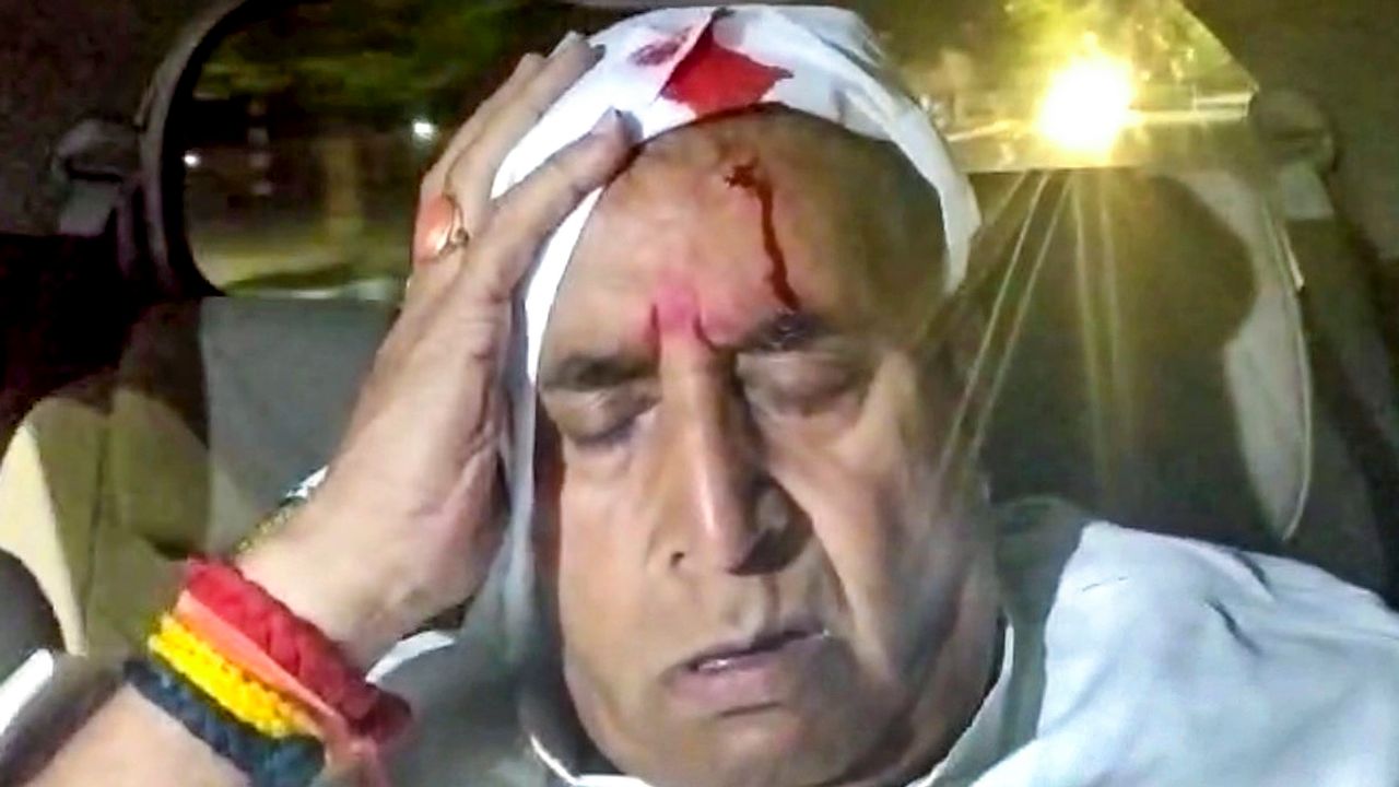 Ex-Maharashtra home minister Anil Deshmukh seriously hurt in stone pelting on his car