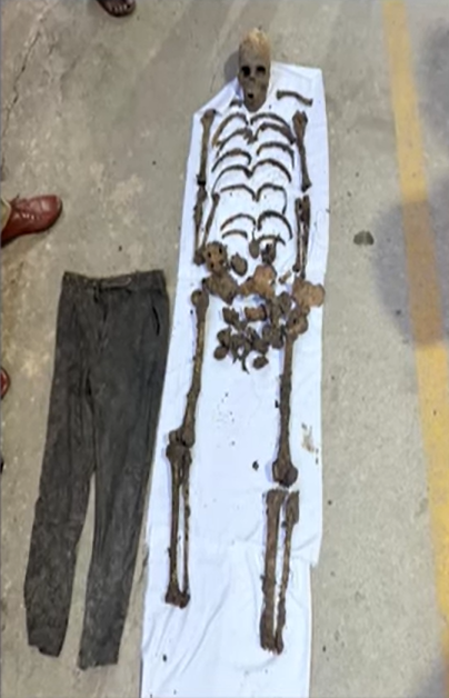 Human Skeleton Discovered in Cesspit of Bengaluru Apartment, Begur Police Launch Probe
