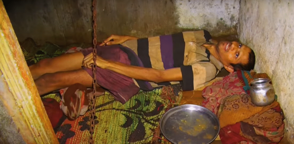 Karnataka: Mentally Ill Man Chained and Locked for Two Years by Family in Sugarcane Field Shed; Rescued by Officials in Uttara Kannada