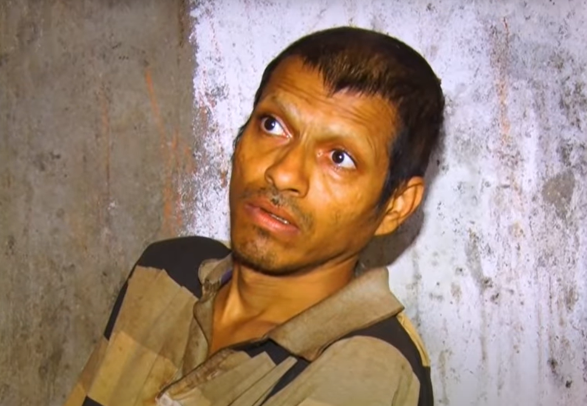 Karnataka: Mentally Ill Man Chained and Locked for Two Years by Family in Sugarcane Field Shed; Rescued by Officials in Uttara Kannada