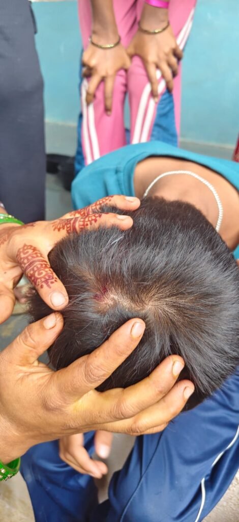 Bagalkot School Roof Concrete Collapses on Students at Mughalolli Tanda; Six Children Safe, Repairs Ordered