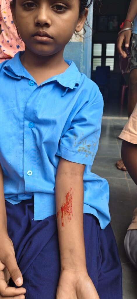 Bagalkot School Roof Concrete Collapses on Students at Mughalolli Tanda; Six Children Safe, Repairs Ordered