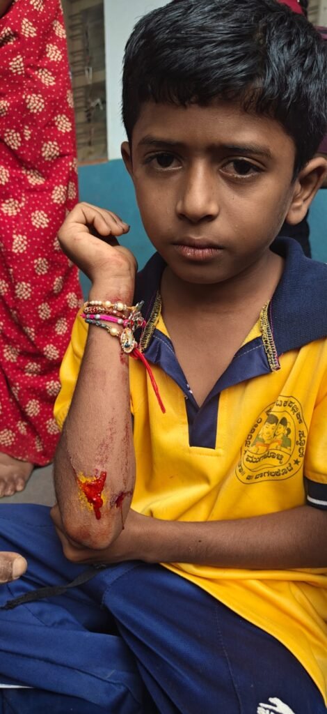 Bagalkot School Roof Concrete Collapses on Students at Mughalolli Tanda; Six Children Safe, Repairs Ordered